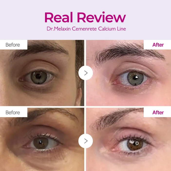 DR MELAXIN Cemenrete Crema Voluminizadora de Calcio