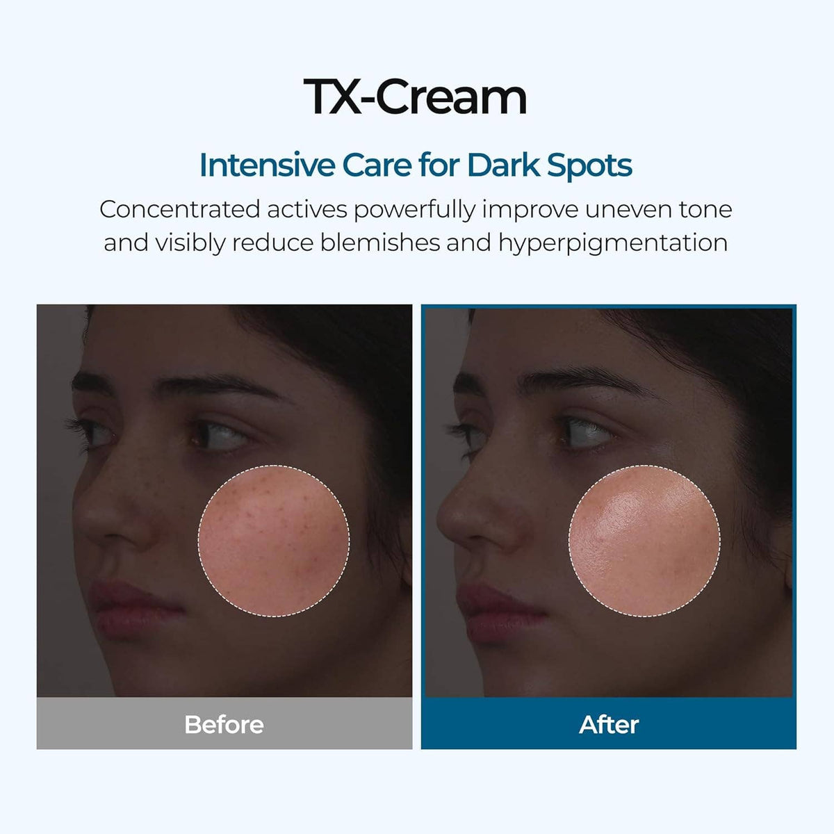 DR MELAXIN TX crema 50 g