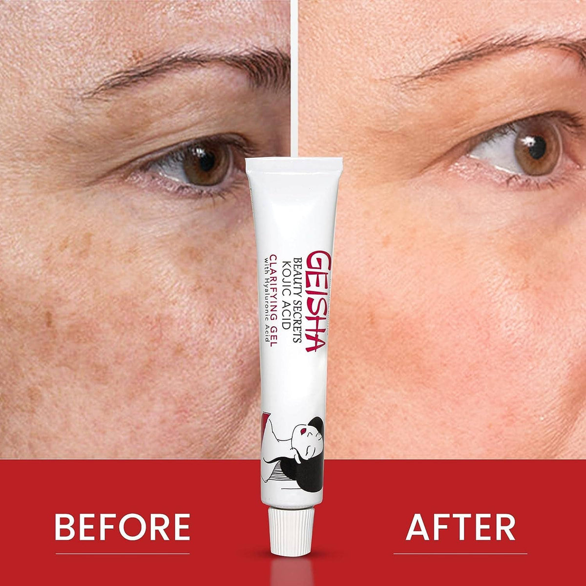 Gel aclarador Geisha con ácido kójico y ácido hialurónico 30 g